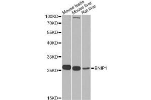Western blot analysis of extracts of various cell lines, using BNIP1 Antibody. (BNIP1 Antikörper)