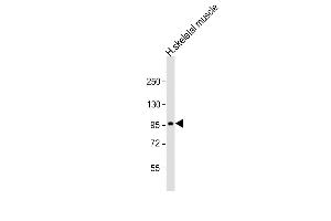 Anti-SULF1 Antibody (C-Term) at 1:2000 dilution + human skeletal muscle lysate Lysates/proteins at 20 μg per lane. (SULF1 Antikörper  (AA 704-738))