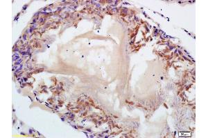 Formalin-fixed and paraffin embedded rat testis labeled with Anti-SPANX Polyclonal Antibody, Unconjugated (ABIN721675) at 1:200 followed by conjugation to the secondary antibody and DAB staining. (SPANXC Antikörper  (AA 21-97))