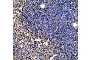 IHC analysis of SYK using anti-SYK antibody (ABIN7599608).