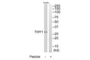 Western blot analysis of extracts from HuvEc cells, using THY1 antibody. (CD90 Antikörper)