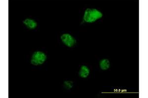 Immunofluorescence of purified MaxPab antibody to RBM6 on HeLa cell. (RBM6 Antikörper  (AA 1-601))