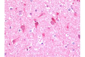 Anti-UFD2A / UBE4B antibody IHC staining of human brain, cortex. (UBE4B Antikörper  (AA 869-1179))