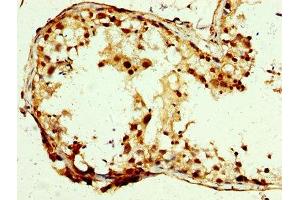 IHC image of ABIN7146356 diluted at 1:250 and staining in paraffin-embedded human testis tissue performed on a Leica BondTM system. (SLC25A24 Antikörper  (AA 1-197))