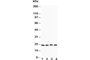 Western blot testing of Caveolin-1 antibody and Lane 1:  HeLa;  2: HT1080;  3: human placenta;  4: A431