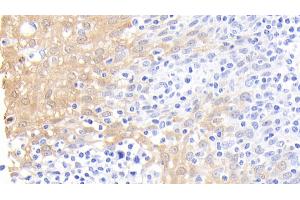 Detection of CALPRO in Human Tonsil Tissue using Polyclonal Antibody to Calprotectin (CALPRO) (S100A8/A9 Complex (Calprotectin) Antikörper  (AA 1-114))