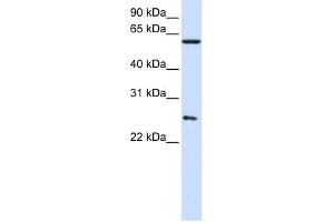 CCT7 antibody used at 1 ug/ml to detect target protein. (CCT7 Antikörper)