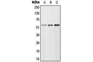 Western blot analysis of TFEB expression in A549 (A), NIH3T3 (B), H9C2 (C) whole cell lysates. (TFEB Antikörper  (N-Term))