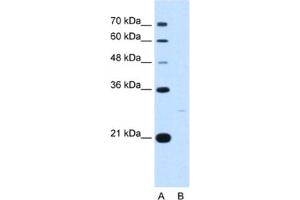 Western Blotting (WB) image for anti-14-3-3 zeta (YWHAZ) antibody (ABIN2463127) (14-3-3 zeta Antikörper)