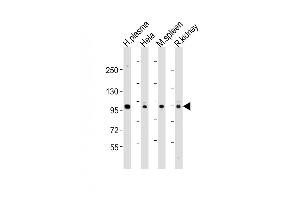 All lanes : Anti-GSN Antibody (N-term) at 1:1000-1:2000 dilution Lane 1: human plasma lysates Lane 2: Hela whole cell lysates Lane 3: mouse spleen lysates Lane 4: rat kidney lysates Lysates/proteins at 20 μg per lane. (Gelsolin Antikörper  (N-Term))