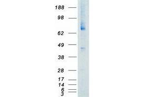 Western Blotting (WB) image for Neurotrophic tyrosine Kinase, Receptor, Type 3 (NTRK3) (Transcript Variant 3) protein (Myc-DYKDDDDK Tag) (ABIN2727198)