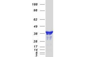 Western Blotting (WB) image for NudE Nuclear Distribution E Homolog (A. Nidulans)-Like 1 (NDEL1) (Transcript Variant 2) protein (Myc-DYKDDDDK Tag) (ABIN2712330)