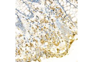 Immunohistochemistry (IHC) image for anti-Fas Ligand (TNF Superfamily, Member 6) (FASL) (AA 100-200) antibody (ABIN3020742)