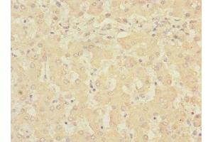 Immunohistochemistry (IHC) image for anti-Ring Finger and CHY Zinc Finger Domain Containing 1, E3 Ubiquitin Protein Ligase (RCHY1) (AA 1-261) antibody (ABIN7168232)