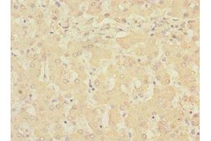 Immunohistochemistry of paraffin-embedded human liver tissue using ABIN7168232 at dilution of 1:100 (RCHY1 Antikörper  (AA 1-261))