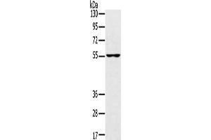 Western Blotting (WB) image for anti-Upstream Binding Protein 1 (LBP-1a) (UBP1) antibody (ABIN2433292) (UBP1 Antikörper)