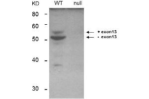 Western Blot of Anti-BIN1 Antibody. (BIN1 Antikörper)
