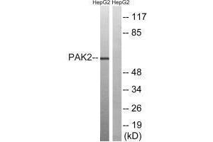 Western blot analysis of extracts from HepG2 cells, treated with serum (20 % , 15 mins), using PAK2 (Ab-192) antibody. (PAK2 Antikörper  (Ser192))