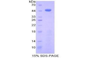SDS-PAGE analysis of Pig beta Thromboglobulin Protein. (beta-Thromboglobulin Protein (beta-TG))