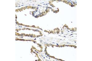 Immunohistochemistry of paraffin-embedded human prostate using OGFR antibody (ABIN5974255) at dilution of 1/100 (40x lens). (OGFR Antikörper)