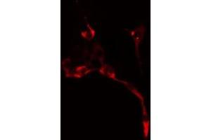 ABIN6278630 staining  NIH-3T3 cells by IF/ICC. (URI1 Antikörper  (Internal Region))