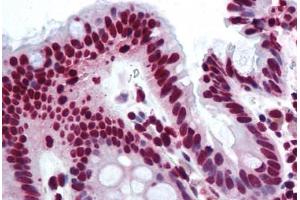 Human Colon (formalin-fixed, paraffin-embedded) stained with THRAP3 antibody ABIN290234 at 10 ug/ml followed by biotinylated goat anti-rabbit IgG secondary antibody ABIN481713, alkaline phosphatase-streptavidin and chromogen. (THRAP3 Antikörper  (AA 930-955))