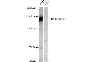 Western blot analysis of extracts of various cell lines, using Desmoglein 3 antibody (ABIN6127804, ABIN6139833, ABIN6139834 and ABIN6224465) at 1:500 dilution. (Desmoglein 3 Antikörper  (AA 749-999))