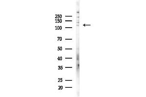 anti-RAS P21 Protein Activator (GTPase Activating Protein) 1 (RASA1) (C-Term) antibody