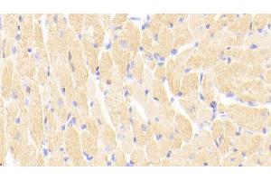 Detection of cTnI in Mouse Cardiac Muscle Tissue using Polyclonal Antibody to Cardiac Troponin I (cTnI) (TNNI3 Antikörper  (AA 1-211))