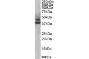Western Blotting (WB) image for anti-Tripartite Motif Containing 54 (TRIM54) (C-Term) antibody (ABIN2465974) (TRIM54 Antikörper  (C-Term))