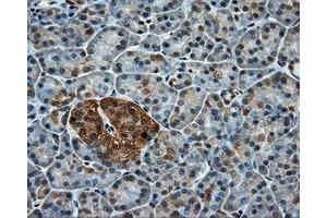 Immunohistochemical staining of paraffin-embedded colon tissue using anti-PPP5C mouse monoclonal antibody. (PP5 Antikörper)