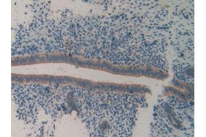 IHC-P analysis of Mouse Uterus Tissue, with DAB staining. (ITGA2 Antikörper  (AA 212-370))