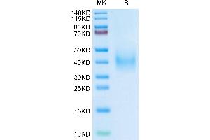 SDS-PAGE (SDS) image for Plasminogen Activator, Urokinase Receptor (PLAUR) (AA 115-305) protein (His tag) (ABIN7275405)