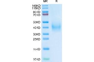 Human uPAR Domain (2+3) on Tris-Bis PAGE under reduced condition. (PLAUR Protein (AA 115-305) (His tag))