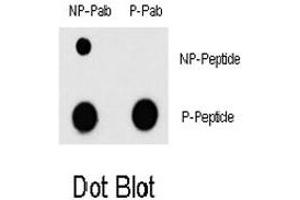 Dot blot analysis of MEF2C (phospho T300) polyclonal antibody  and MEF2C Non Phospho-specific polyclonal antibody on nitrocellulose membrane. (MEF2C Antikörper  (pThr300))