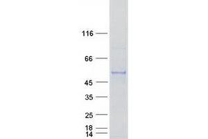 Western Blotting (WB) image for Cytochrome P450, Family 2, Subfamily S, Polypeptide 1 (CYP2S1) protein (Myc-DYKDDDDK Tag) (ABIN2712773)