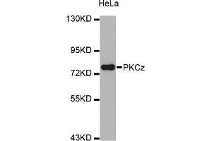Western blot analysis of extracts of HeLa cell line, using PRKCZ antibody. (PKC zeta Antikörper)