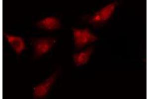 ABIN6275012 staining  HeLa cells by IF/ICC. (KIF4A Antikörper  (C-Term))