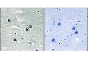 Immunohistochemistry analysis of paraffin-embedded human brain, using MER/SKY (Phospho-Tyr749/681) Antibody. (MER/SKY (AA 716-765), (pTyr749) Antikörper)