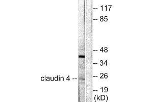 Western Blotting (WB) image for anti-Claudin 4 (CLDN4) (C-Term) antibody (ABIN1848452)