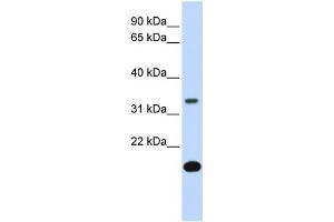 WB Suggested Anti-FST Antibody Titration:  0. (Follistatin Antikörper  (Middle Region))