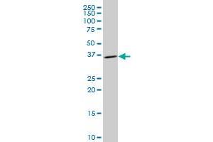 CNN3 polyclonal antibody (A01), Lot # 060111JC01 Western Blot analysis of CNN3 expression in HepG2 . (CNN3 Antikörper  (AA 230-329))