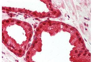 Rabbit Anti-MAT2A antibody Catalog Number: ARP46144 Formalin Fixed Paraffin Embedded Tissue: Human Prostate Primary antibody Concentration: 1:200 Secondary Antibody: Donkey anti-Rabbit-Cy3 Secondary Antibody Concentration: 1:200 Magnification: 20x Exposure Time: 0. (MAT2A Antikörper  (Middle Region))