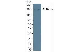 Detection of PLCb3 in Human A431 cells using Polyclonal Antibody to Phospholipase C Beta 3, Phosphoinositide Specific (PLCb3) (Phospholipase C beta 3, Phosphoinositide Specific (AA 318-468) Antikörper)