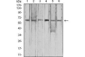 Western Blotting (WB) image for anti-Complement Factor H-Related 5 (CFHR5) (AA 344-569) antibody (ABIN5542640)