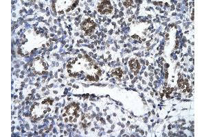 Rabbit Anti-ZNF148 Antibody       Paraffin Embedded Tissue:  Human alveolar cell   Cellular Data:  Epithelial cells of renal tubule  Antibody Concentration:   4. (ZNF148 Antikörper  (Middle Region))