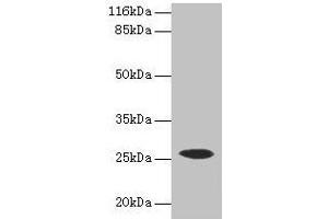 Western blot All lanes: CSHL1 antibody at 2 μg/mL + Human placenta tissue Secondary Goat polyclonal to rabbit IgG at 1/10000 dilution Predicted band size: 26, 23, 16, 15 kDa Observed band size: 26 kDa