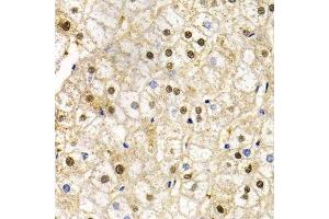 Immunohistochemistry (Paraffin-embedded Sections) (IHC (p)) image for anti-RAD9 Homolog A (S. Pombe) (RAD9A) (AA 162-391) antibody (ABIN3022652)