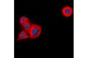 Immunofluorescent analysis of LCK staining in HeLa cells. (LCK Antikörper)