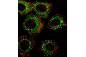 Fluorescent image of A549 cell stained with FADS2 Antibody (N-term) (ABIN656230 and ABIN2845545)/SA110322AN.